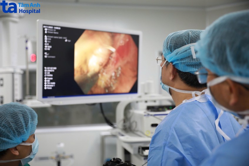 phẫu thuật nội soi cắt dưới niêm mạc