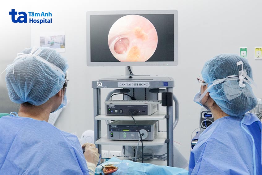 phẫu thuật nội soi vá nhĩ cho một người bệnh