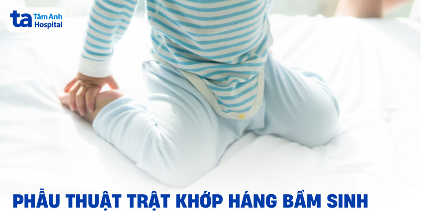 phẫu thuật trật khớp háng bẩm sinh