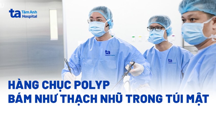Hàng chục polyp bám như thạch nhũ trong túi mật