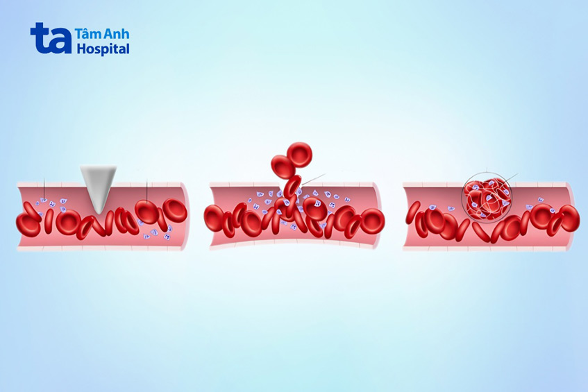 quá trình đông máu khi mạch máu tổn thương
