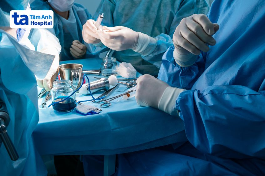 quy trình cắt u nhú hậu môn