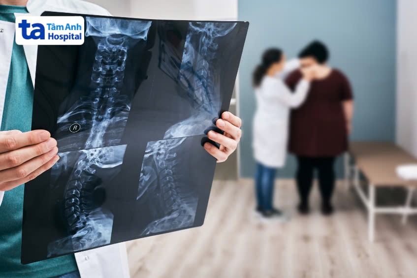 quy trình x quang toàn thân