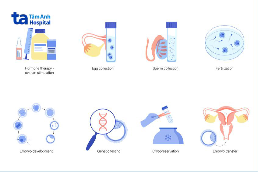 Quy trình thực hiện thụ tinh trong ống nghiệm (IVF)