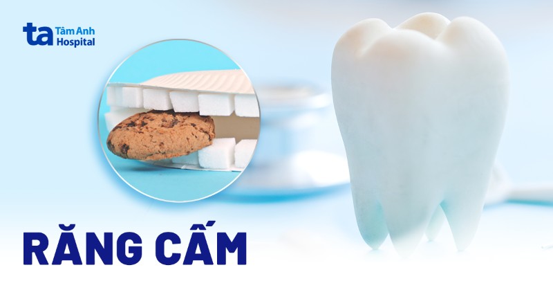 răng cấm