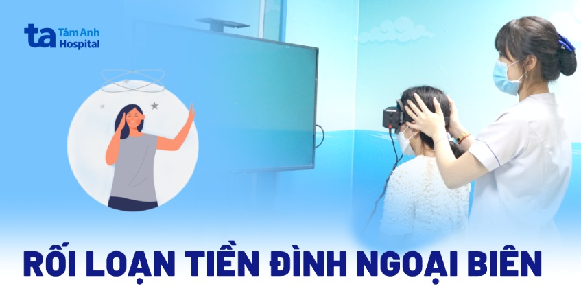 rối loạn tiền đình ngoại biên