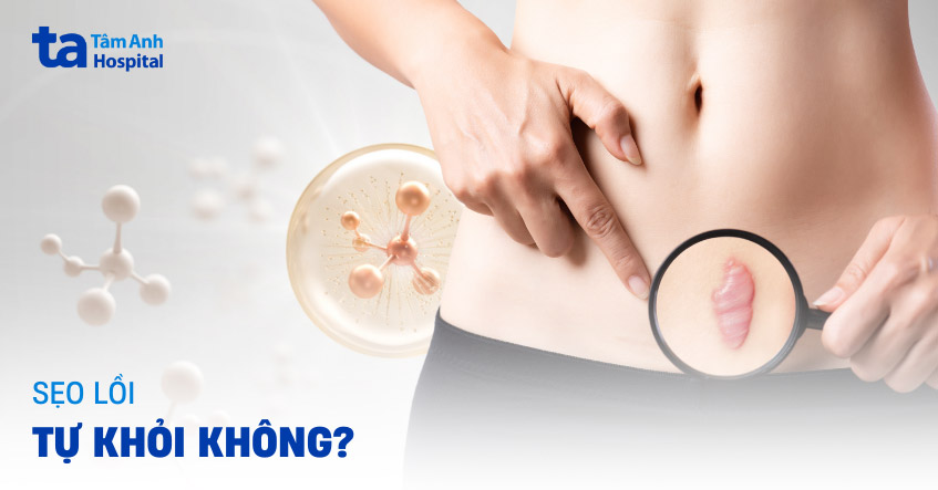 Sẹo lồi có tự khỏi không? Có hết được không?