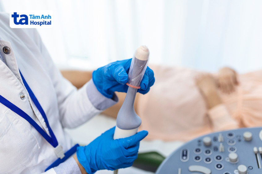 Siêu âm đầu dò âm đạo có độ chính xác cao, cho hình ảnh rõ nét hơn ở buồng trứng và vùng chậu