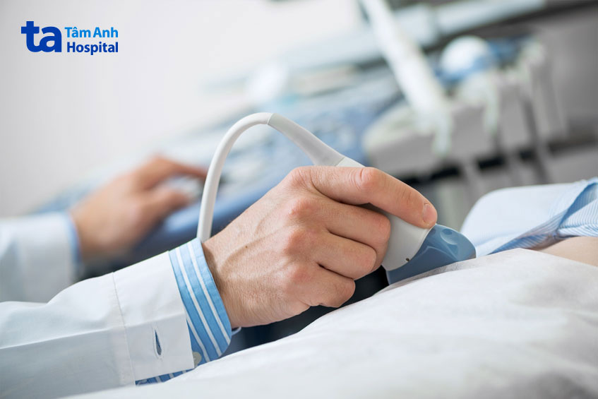 siêu âm ổ bụng để xác định nang thận