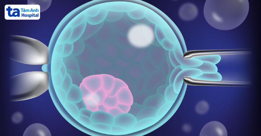 Sinh thiết phôi để thực hiện các xét nghiệm chuyên sâu nhằm đánh giá chất lượng phôi