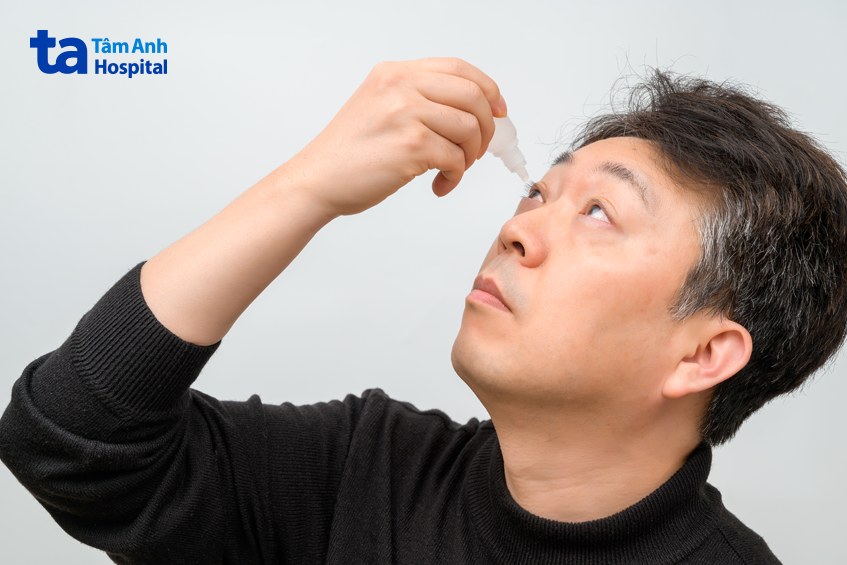 sử dụng thuốc nhỏ mắt theo chỉ định