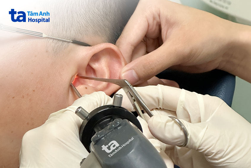 tai một người bệnh đang được nội soi