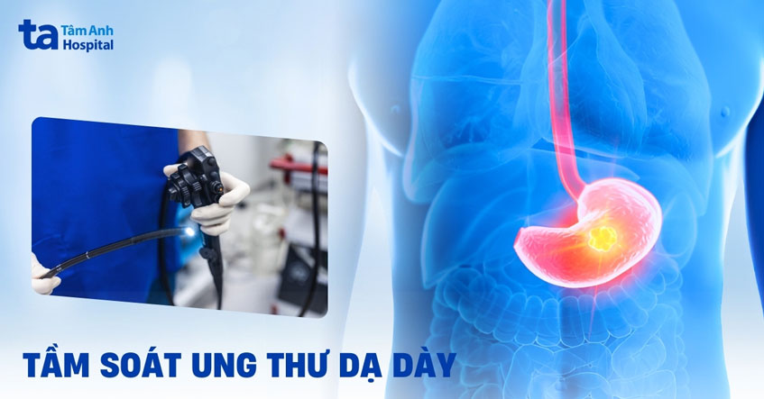 Tầm soát ung thư dạ dày bằng cách nào? Các phương pháp khám chẩn đoán