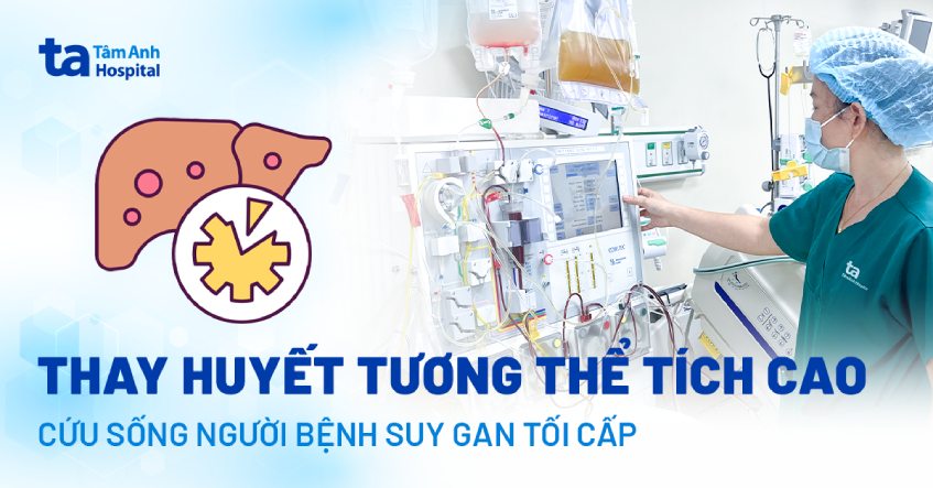 Thay huyết tương thể tích cao cứu sống người bệnh suy gan tối cấp