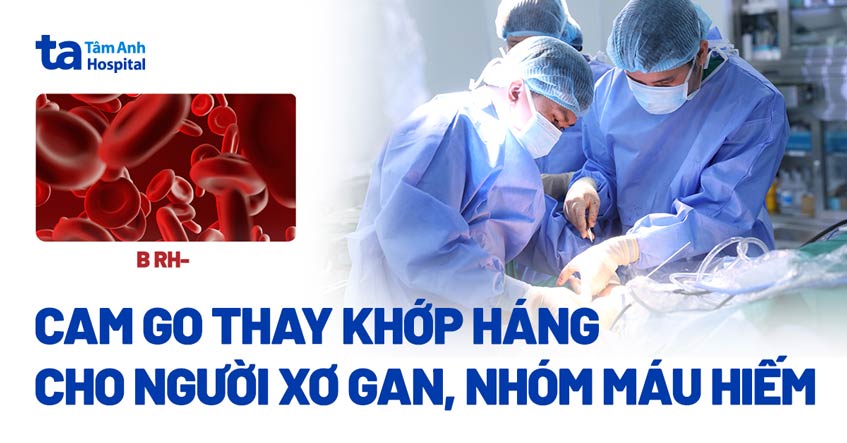 thay khớp háng cho người xơ gan