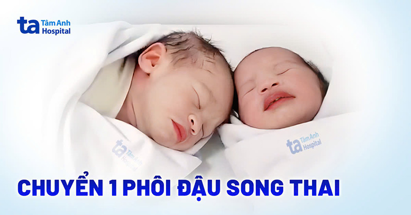Thụ tinh ống nghiệm chuyển một phôi đậu thai đôi