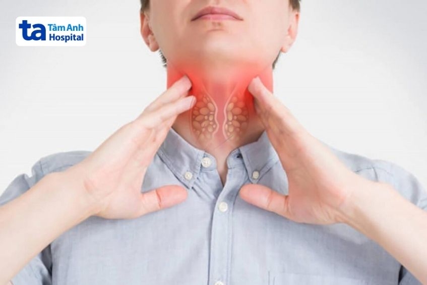 tiêm hpv cho nam phòng ung thư vòm họng