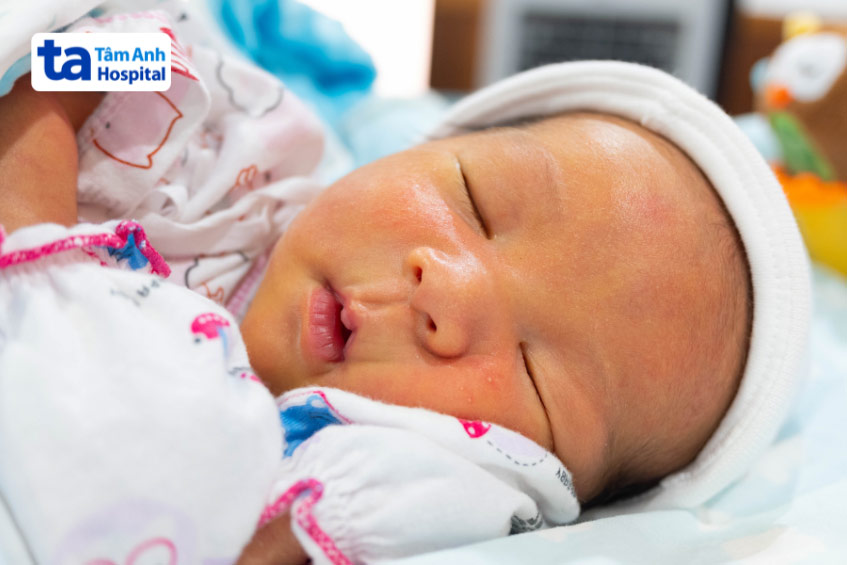trẻ sơ sinh vàng da sinh lý