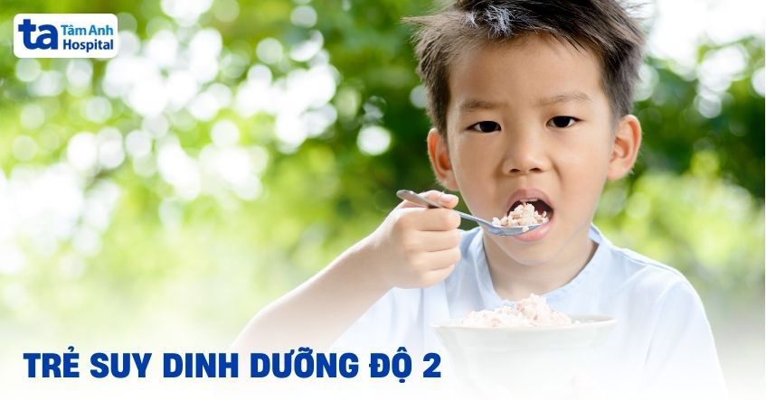 Trẻ suy dinh dưỡng độ 2: Dấu hiệu, chẩn đoán và cách cải thiện
