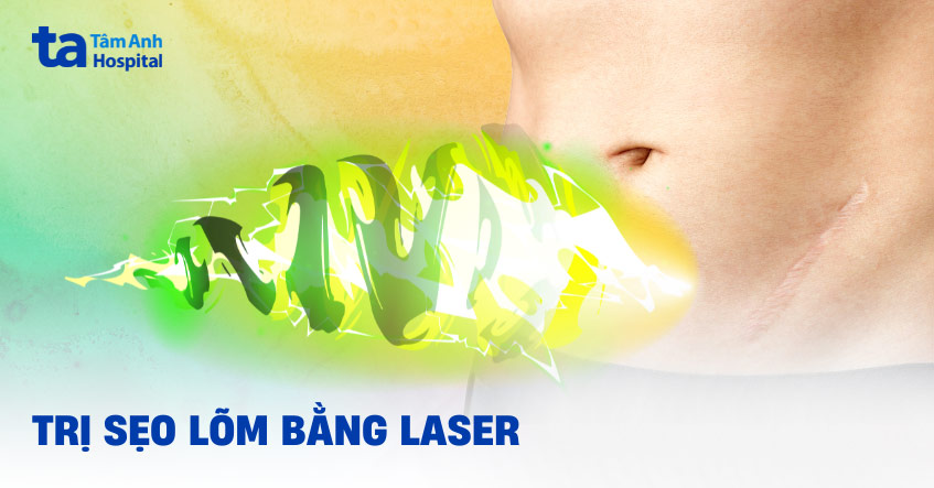 Trị sẹo lõm bằng laser có hiệu quả không? Ưu và nhược điểm