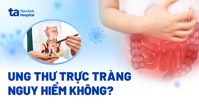 Ung thư trực tràng có nguy hiểm không? Ảnh hưởng đến sức khỏe ra sao?