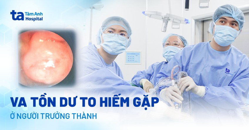 Nam thanh niên mắc bệnh VA, ít gặp ở người trưởng thành