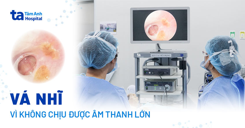 Thủng nhĩ phải vá vì không chịu được âm thanh lớn