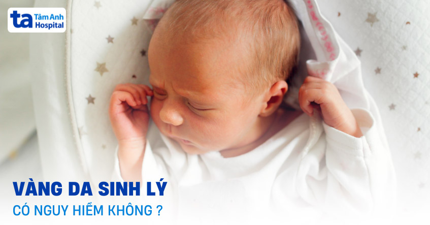Vàng da sinh lý có nguy hiểm không? Có ảnh hưởng gì không?