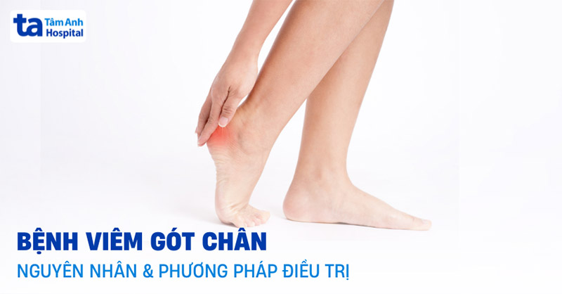 viêm gót chân có nguy hiểm không viêm gót chân có nguy hiểm không