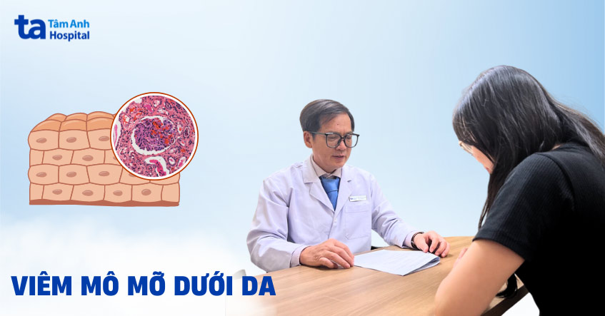 viêm mô mỡ dưới da