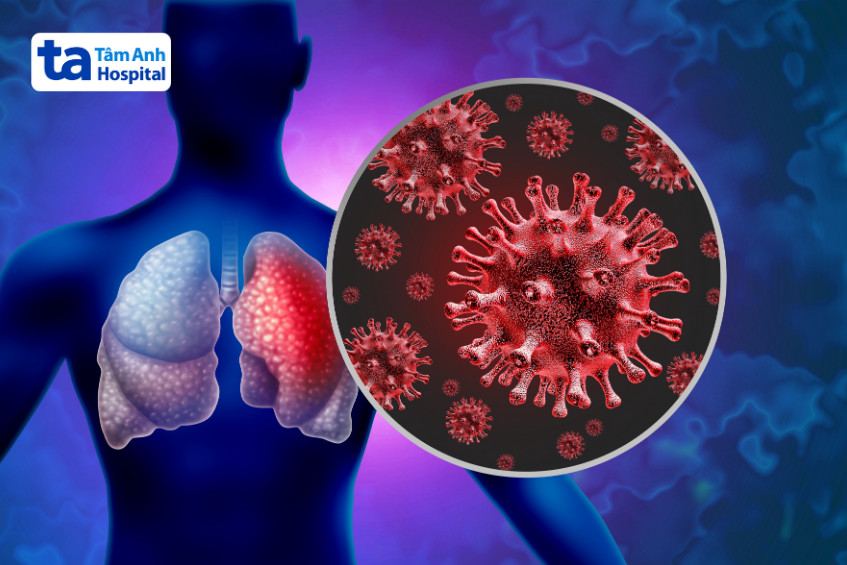 Viêm phổi kẽ không đặc hiệu có thể xảy ra do nhiều tác nhân