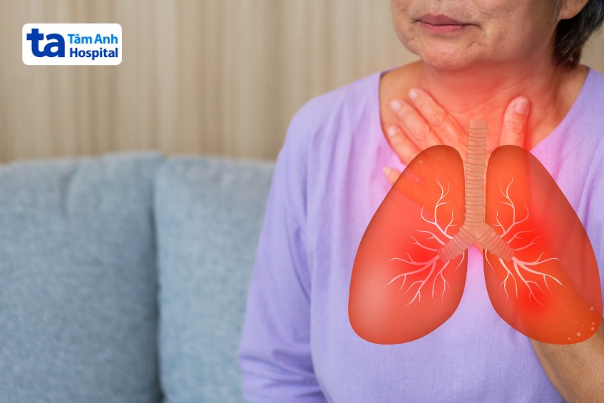 Viêm phổi kẽ không đặc hiệu có triệu chứng kéo dài dai dẳng