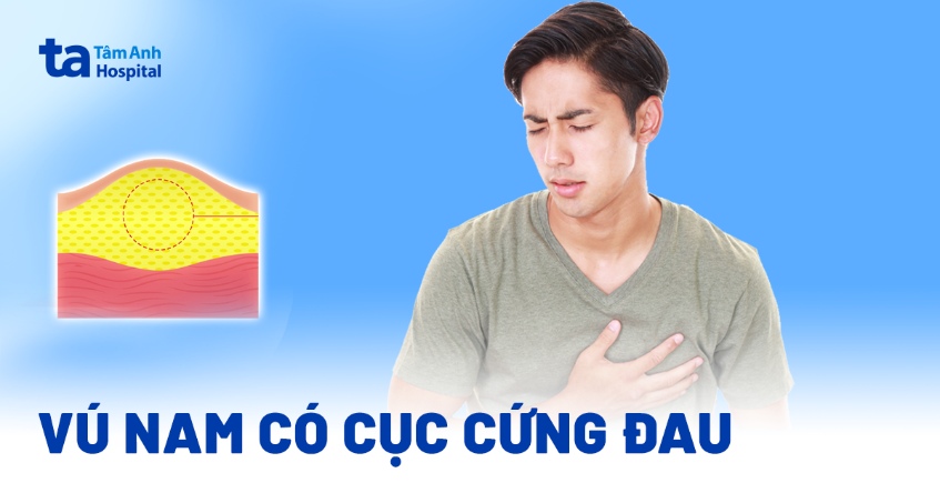 Vú nam có cục cứng đau hoặc không đau là bị gì? Có nguy hiểm không?