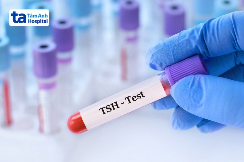 xét nghiệm chức năng tuyến giáp
