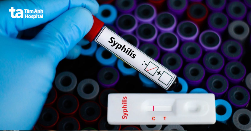 xét nghiệm máu là phương pháp chẩn đoán giang mai
