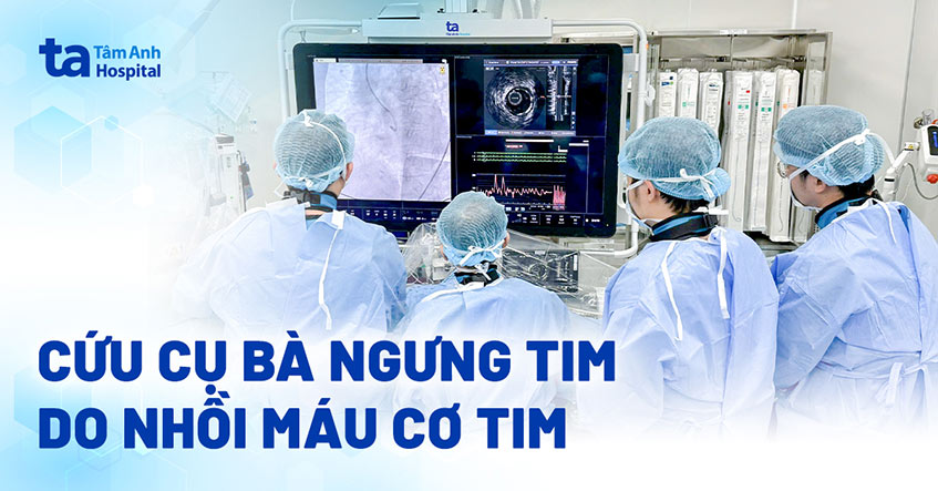 100 phút cứu cụ bà ngưng tim do nhồi máu cơ tim