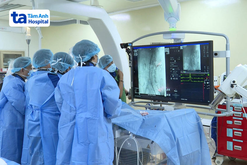 Các bác sĩ tại BVĐK Tâm Anh đặt stent cho bệnh nhân bị tắc hẹp mạch vành