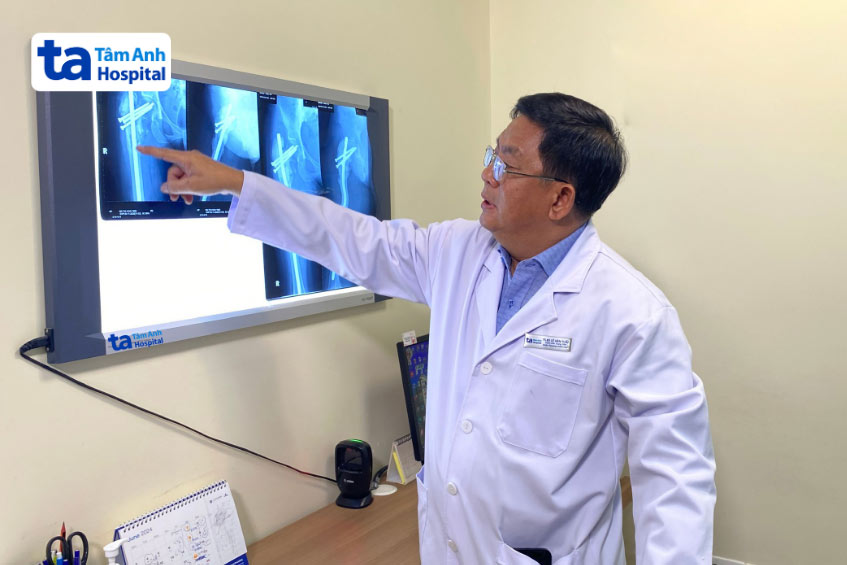 bác sĩ tuấn phân tích tình trạng u xương