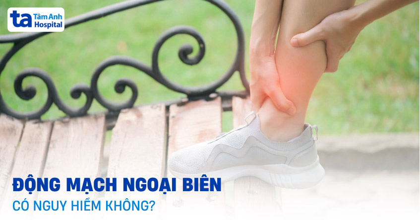 Bệnh động mạch ngoại biên: Nguyên nhân, triệu chứng và điều trị