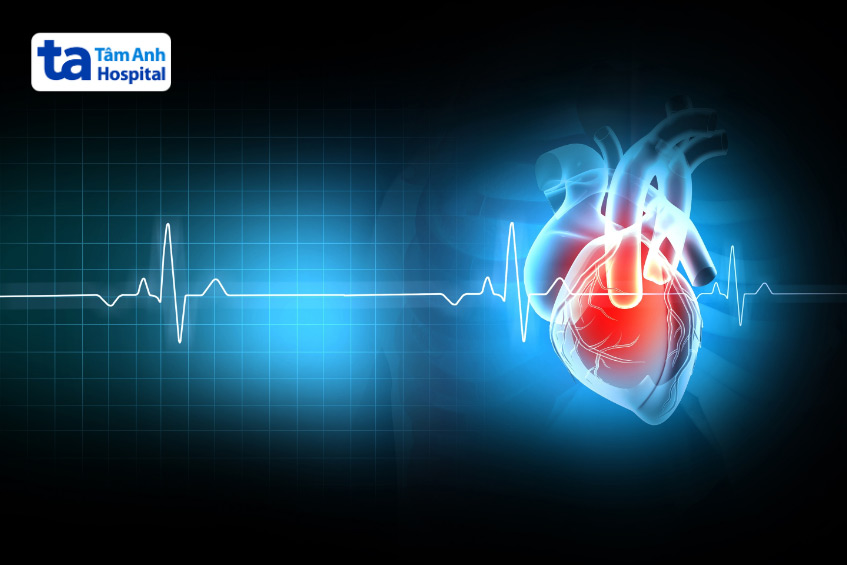 Bệnh nhân bị nhịp tim chậm được chỉ định đặt máy tạo nhịp tim tạm thời