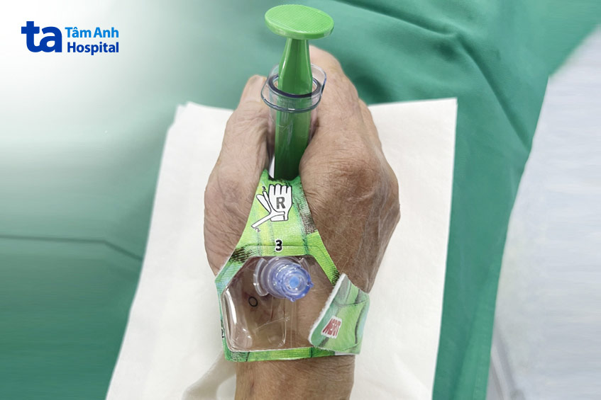 Bệnh nhân cần chăm sóc tốt vị trí đặt ống thông để tránh bị nhiễm trùng