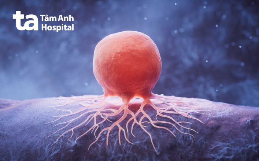 biến chứng viêm thanh quản mạn