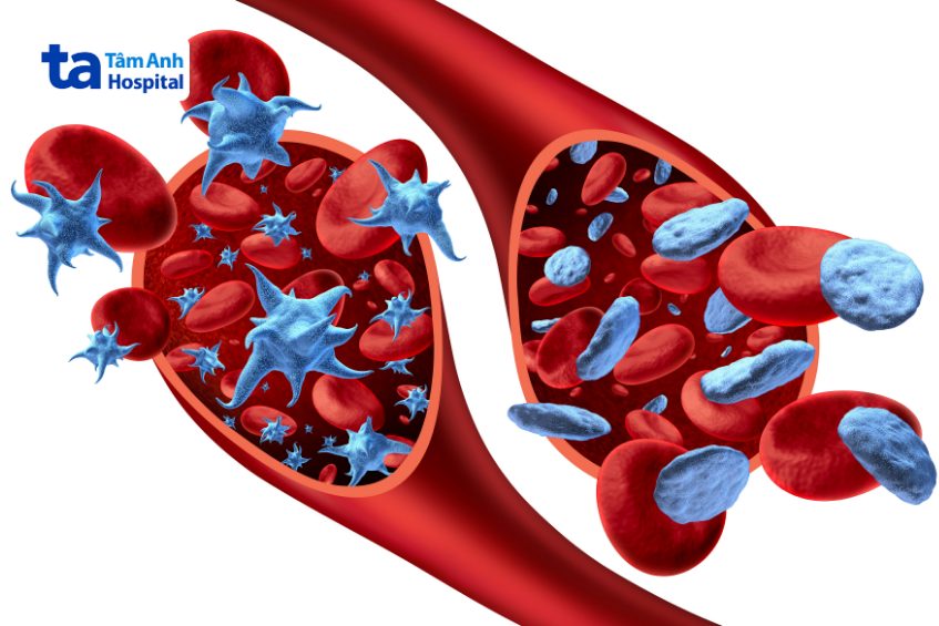 biểu hiện xuất huyết giảm tiểu cầu