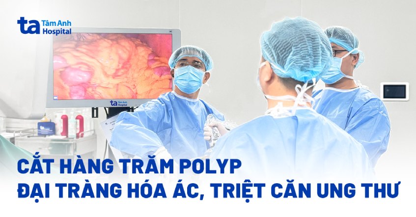Cắt hàng trăm polyp đại tràng hóa ác, triệt căn ung thư