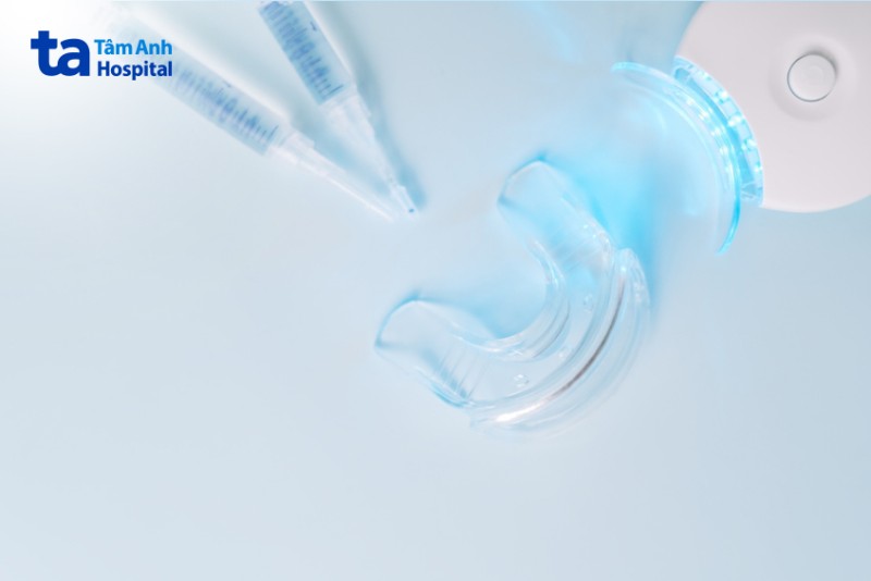 Phương pháp đeo máng tẩy trắng răng tại nhà