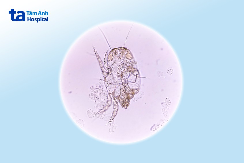 cái ghẻ trong máu bệnh phẩm