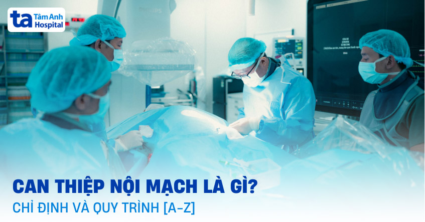 Can thiệp nội mạch là gì? Ưu điểm, chỉ định và quy trình [A-Z]