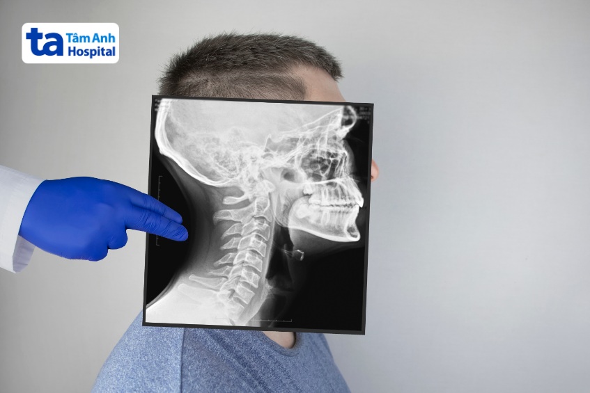 chẩn đoán bệnh lý ở hộp sọ người