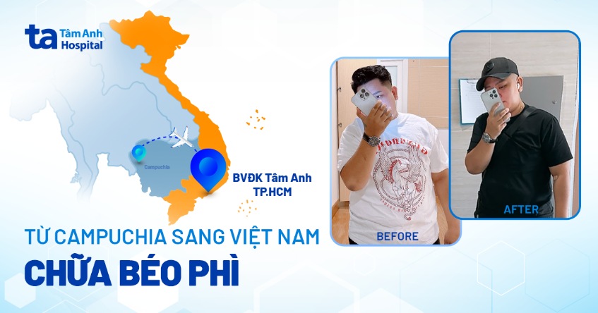 Giấc mơ có thật, chàng trai Campuchia giảm 22kg nhờ bác sĩ Việt Nam