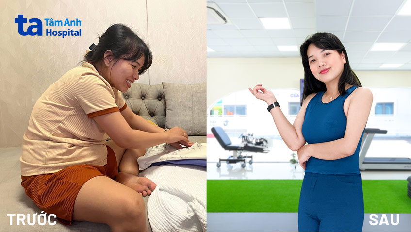 Chị Thảo trước và sau 3 tháng giảm cân